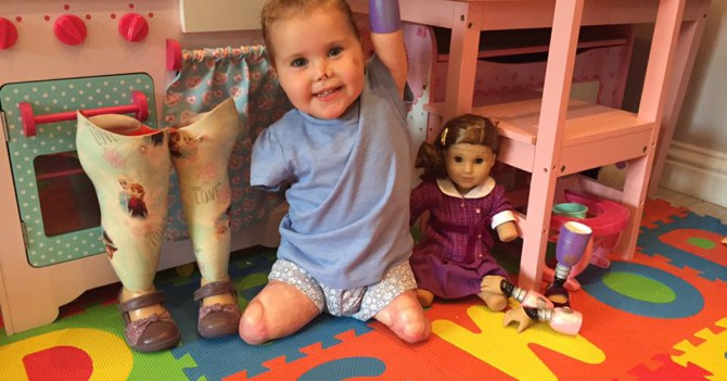 Малышка-инвалид получила специальную куклу, которая выглядит так же