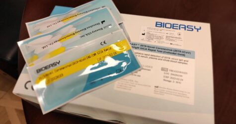 В Киеве появились первые тесты на коронавирус