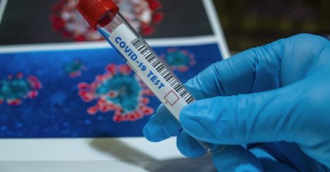 ПЦР тест для определения гриппа и COVID-19: разработка украинских учёных