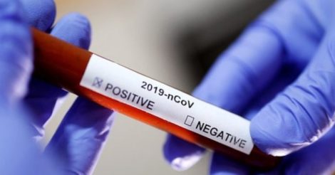 В Украине зафиксировано 20 тысяч случаев заражения коронавирусом