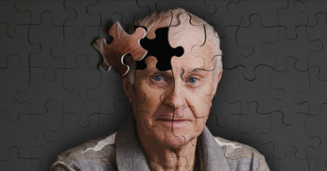 Новое лекарство от Альцгеймера зарегистрировали в США