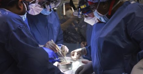 Ученые в США впервые пересадили свиное сердце человеку