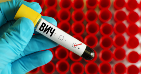 Он убивает быстрее: ученые в Нидерландах обнаружили новый штамм ВИЧ