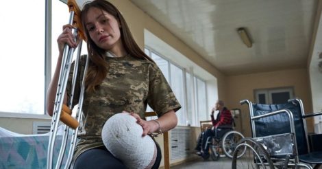 Втратила ногу після російського обстрілу: вражаюча історія 18-річної дівчини, яка добровільно вступила до лав ЗСУ
