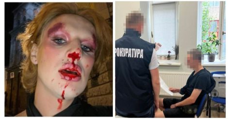 Побиття трансгендерної військової у Льовові: поліція затримала нападника, фото