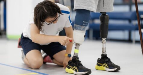 Українці зможуть отримати безоплатне протезування: подробиці